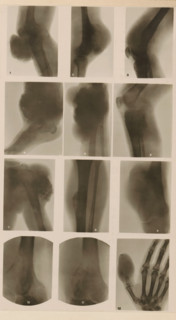 Twelve x-rays of different joints, photograph, page, name: 'Dr. Hauchamps.', c. 1904 - in or before