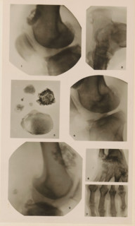 Seven x-rays of various joints and substances, photograph, page, name: 'Dr. Lejeune.', c. 1904 - in