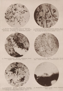 Six microscope images of bacteria, including tuberculosis and leprosy bacilli, page,