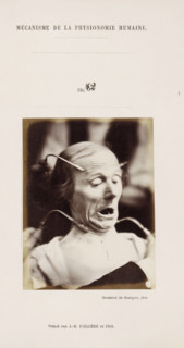 Test Subject undergoing Electrostimulation, photograph, page, Unnumbered page with photo 62 from