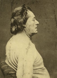 Frédéric Lemaître