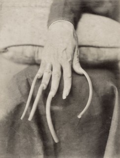 Chine, main aux ongles non coupés