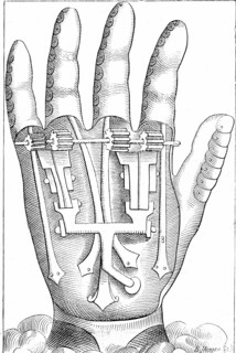 Artificial hand prosthesis