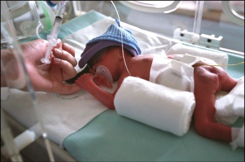 03/02/2002. Premature babies at the intensive care unit of the Cochin hospital.