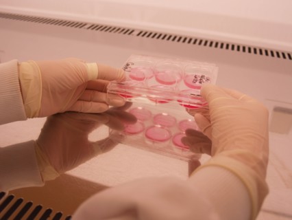 Culturing cells