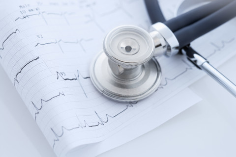 Closeup of stethoscope on monitor printout.