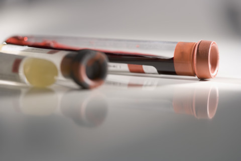 Closeup of blood samples in tubes.