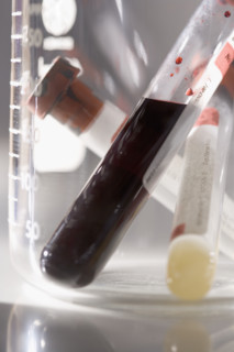 Closeup of blood samples in tubes.