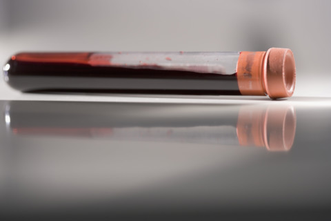 Closeup of blood sample in tube.