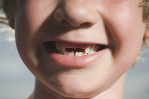 Boy with missing teeth smiling. Date : 2007