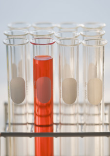Close up of vials in tray .