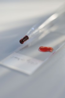 Drop of blood on slide.