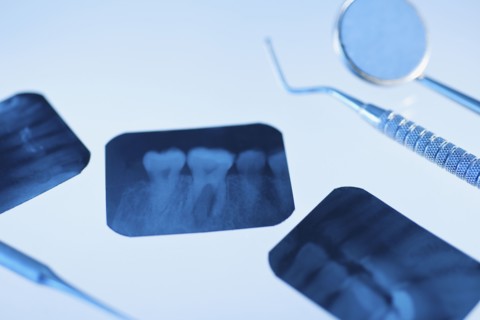 Dental instruments and x-rays.