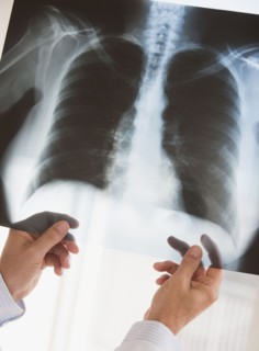 Chest x-ray.