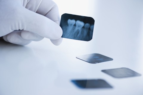 Dental x-ray.