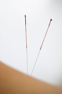 Acupuncture needles.