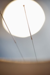Acupuncture needles.