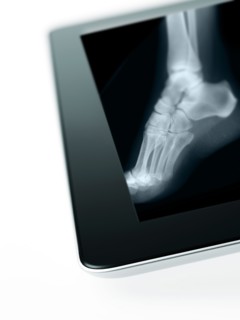 Studio shot of digital tablet with x-ray of human foot. Photo : David Arky