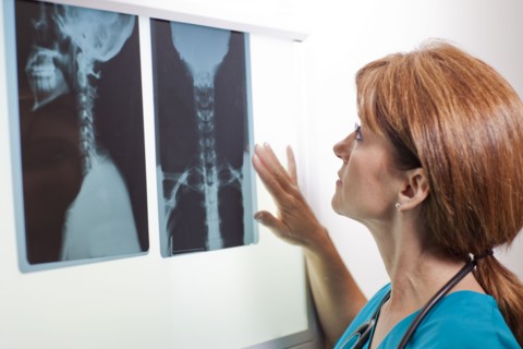 Doctor looking at x-ray. Photo: db2stock