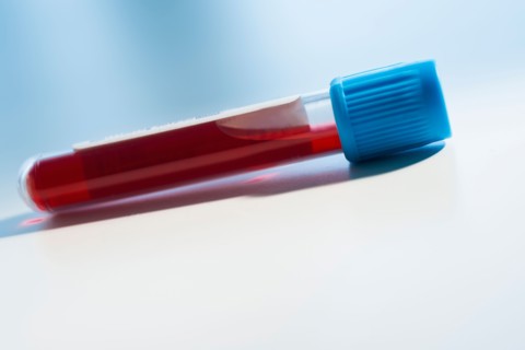 Studio shot of blood sample.