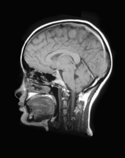 MRI Scan of human head. 
Photo : Calysta Images