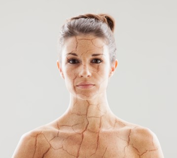 Head and shoulders shot of woman with cracked skin. Photo : Mike Kemp