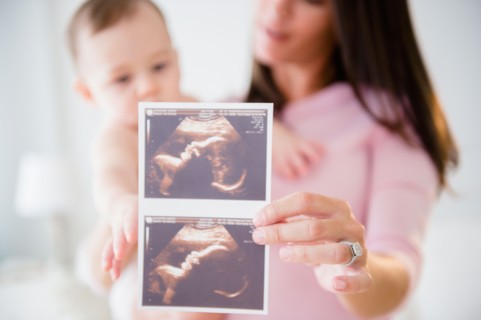 Mother with daughter (6-11 months) holding ultrasound scan