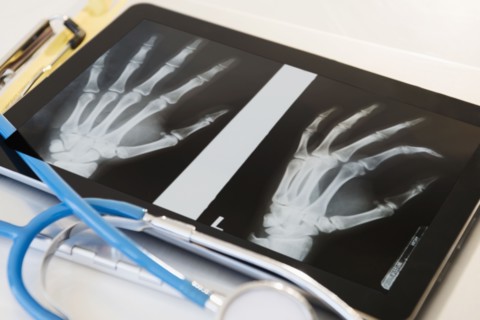 X-ray of human hand on digital tablet