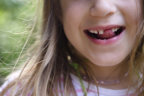 Girl with missing tooth