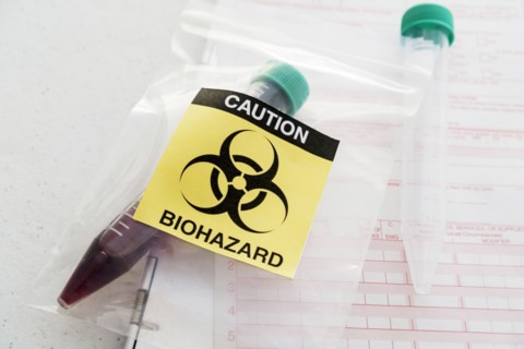 Blood sample with biohazard sign