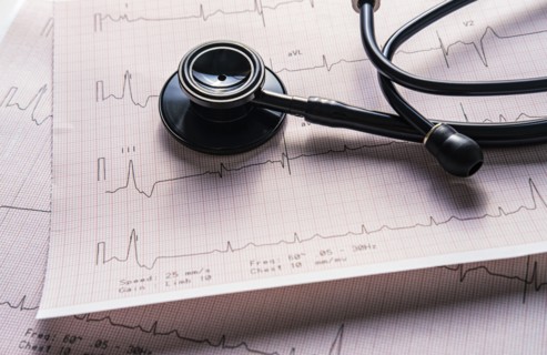 Stethoscope on electrocardiogram