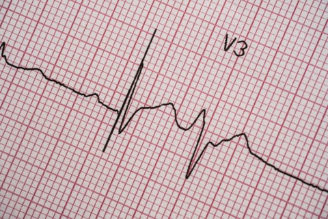 Electrocardiogram on red graph paper