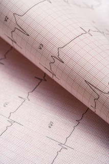 Electrocardiogram on red graph paper