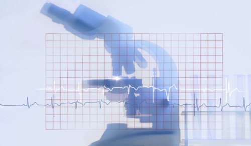 Silhouette of microscope behind electrocardiogram