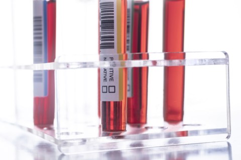 Studio shot of Covid-19 blood samples in test tube rack