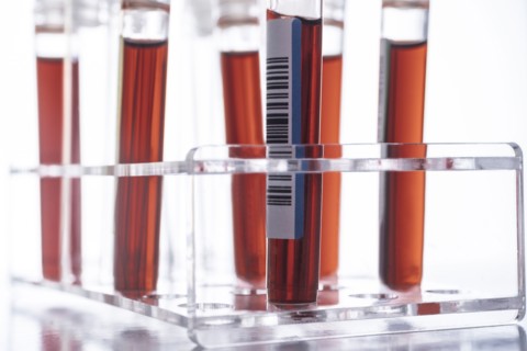 Studio shot of Covid-19 blood samples in test tube rack