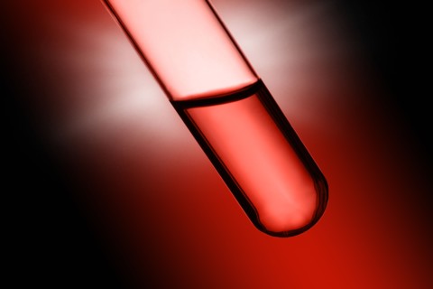 Close-up of blood sample