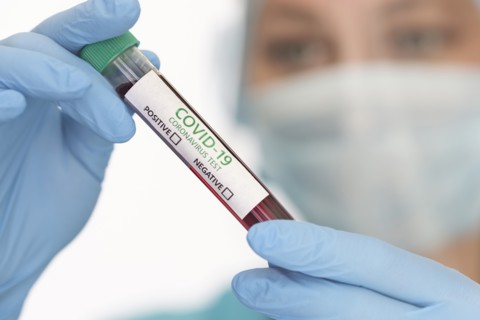 Close-up of doctors hands holding Covid-19 test sample