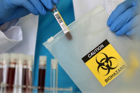Lab professional putting vial into string bag with biohazard sign