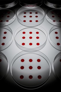 Blood sample tested on petri dish in laboratory