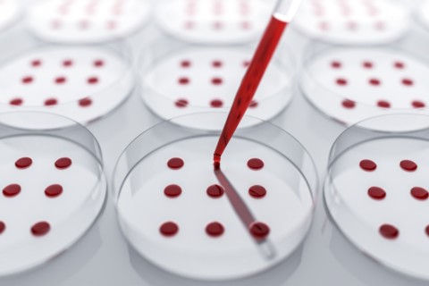 Blood sample tested on petri dish in laboratory