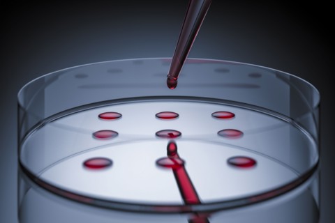 Blood sample tested on petri dish in laboratory