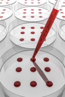 Blood sample tested on petri dish in laboratory