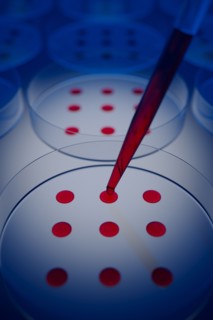 Blood sample tested on petri dish in laboratory