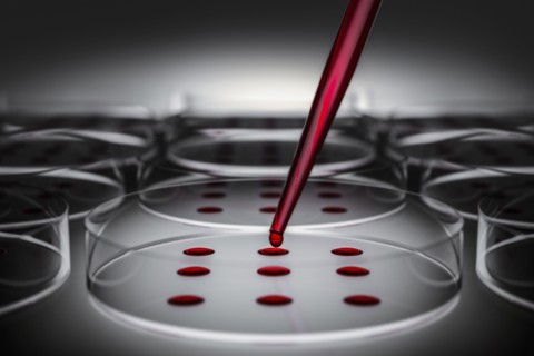Blood sample tested on petri dish in laboratory