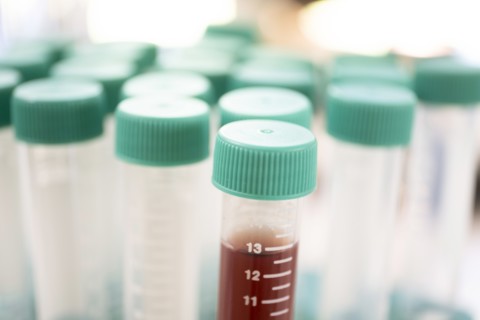 Close-up of test tubes in laboratory