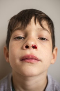 Portrait of Mixed Race boy with bloody nose