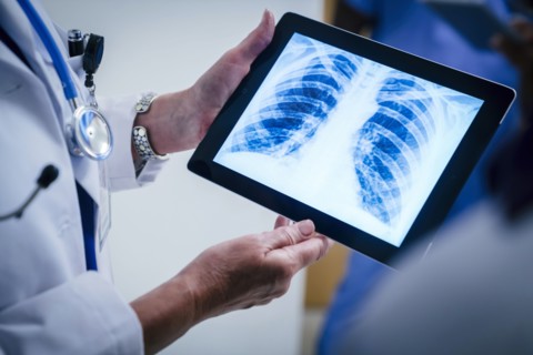 Doctors examining x-ray of chest and ribs on digital tablet