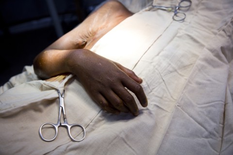 Close up of patient laying in surgery