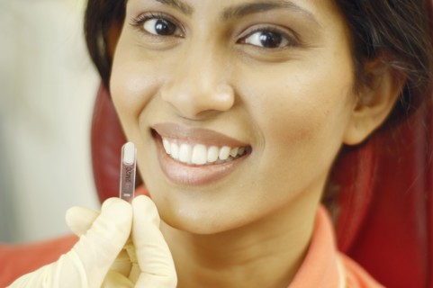 Tooth color sample being held up next to Indian woman's teeth